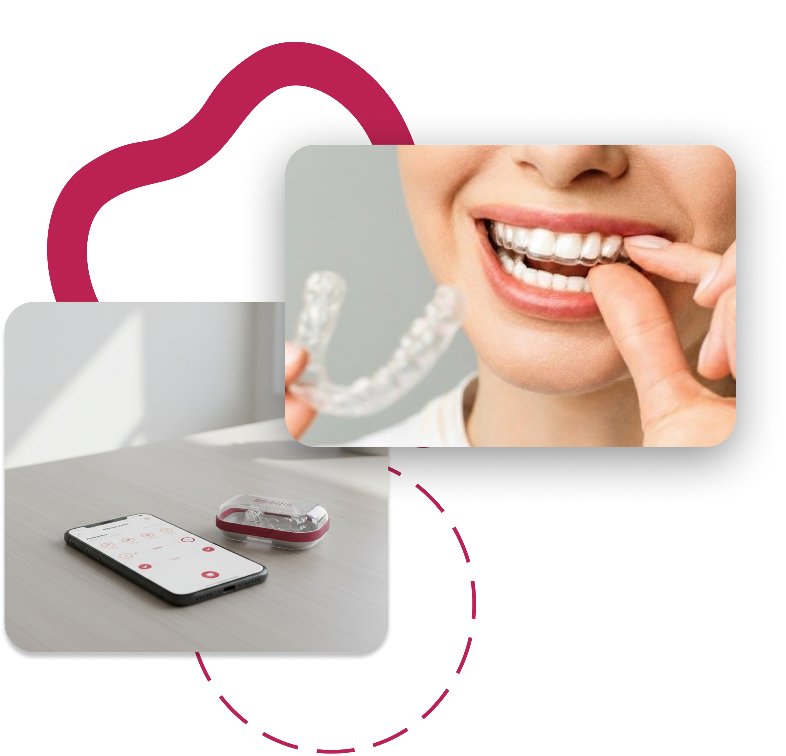 Composite showing aligner usage and remote monitoring
